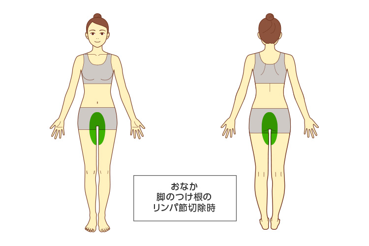 切除に近い部位のイメージ画像